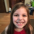 Greta first missing tooth